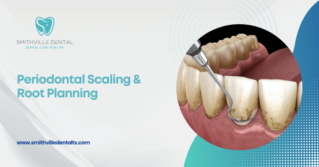 Periodontal scaling root planning smithville dentist