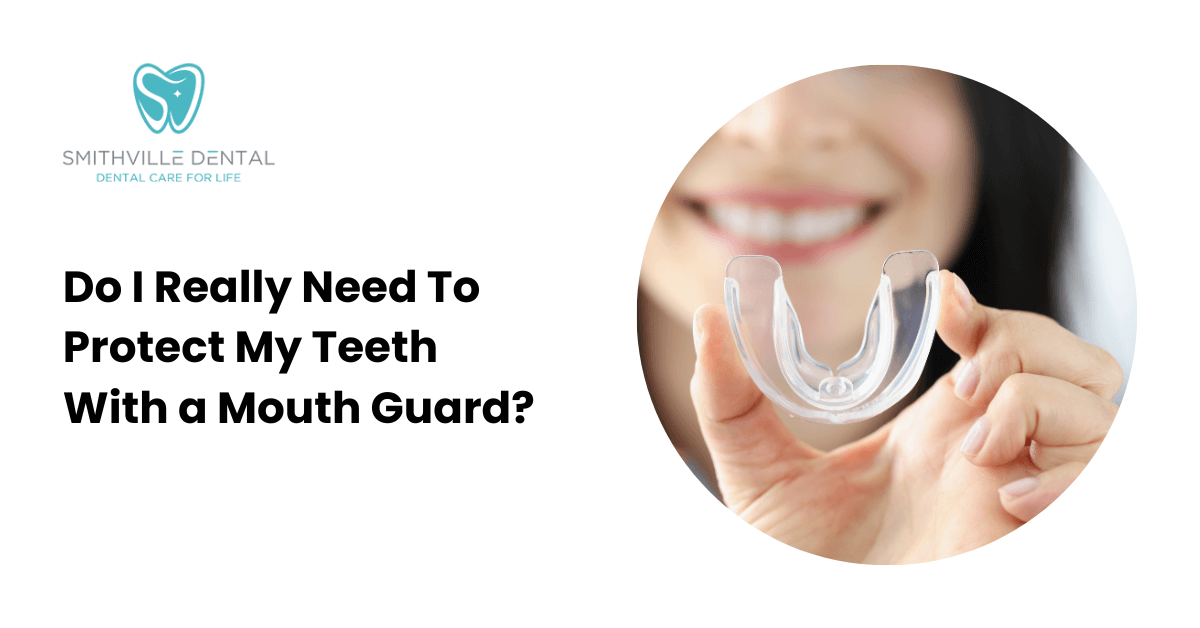 Do I Really Need To Protect My Teeth With a Mouth Guard?