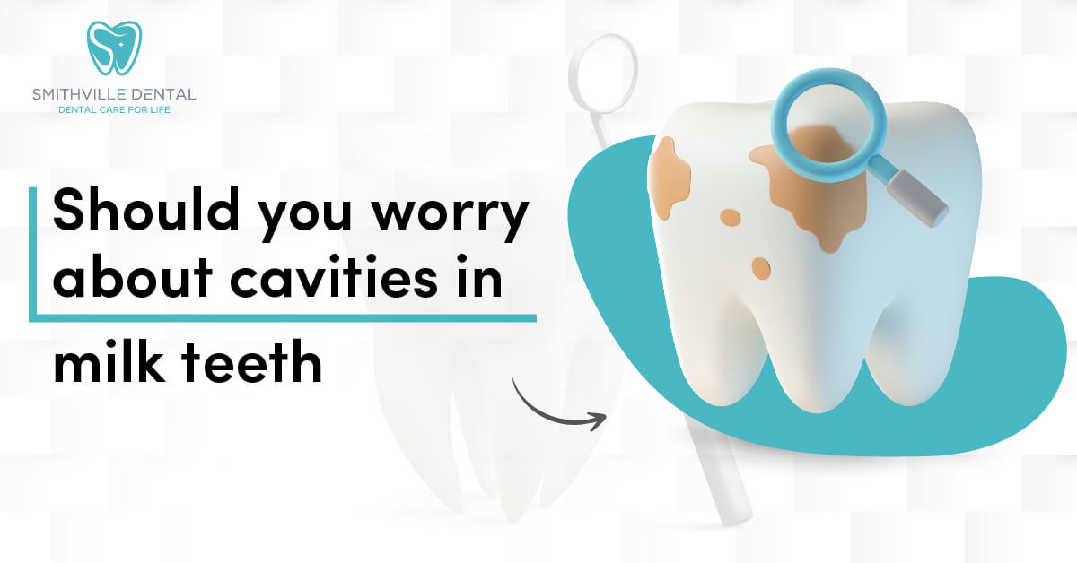 Should you worry about cavities in milk teeth?