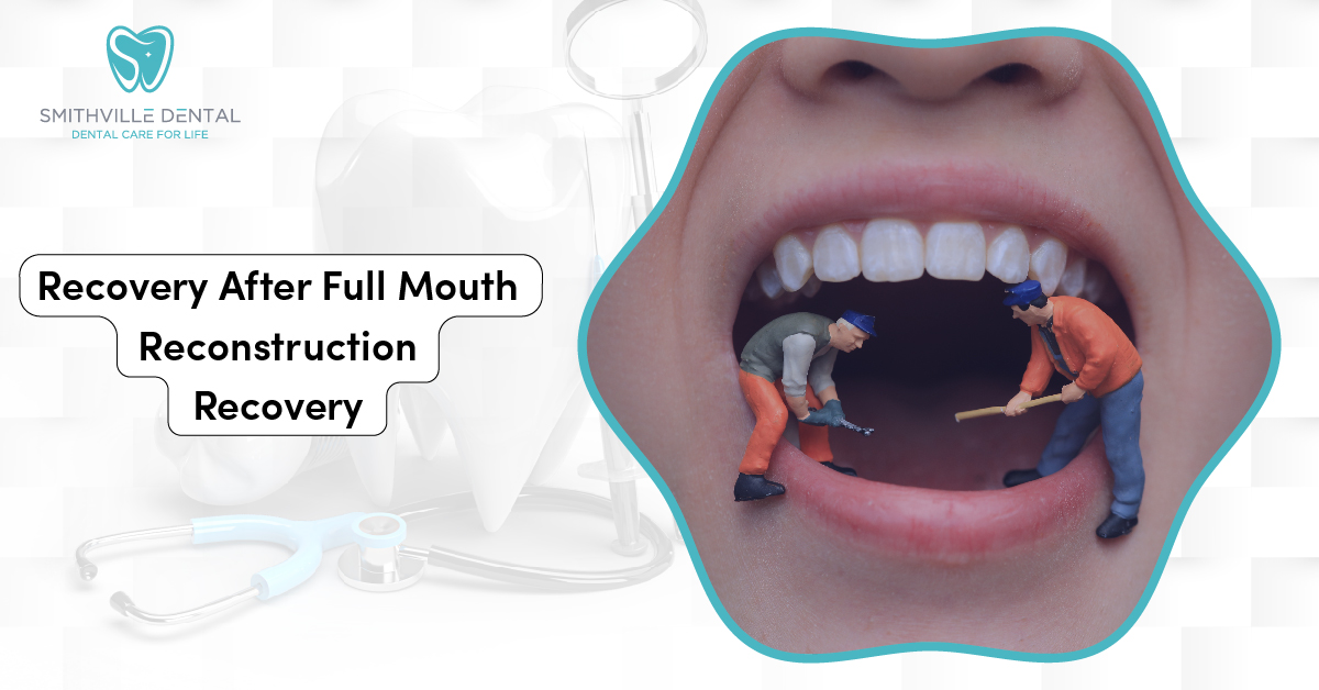 Recovery After Full Mouth Reconstruction Recovery