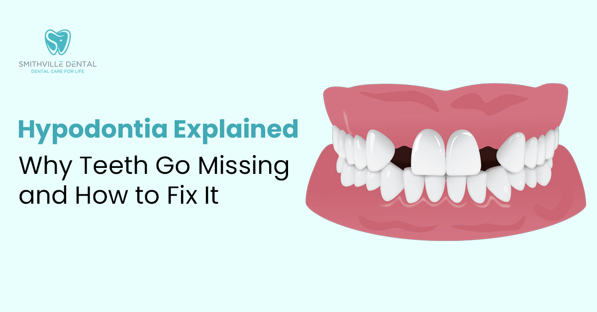 Hypodontia Explained: Why Teeth Go Missing and How to Fix It
