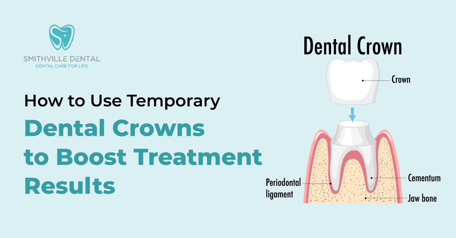 How to Use Temporary Dental Crowns to Boost Treatment Results